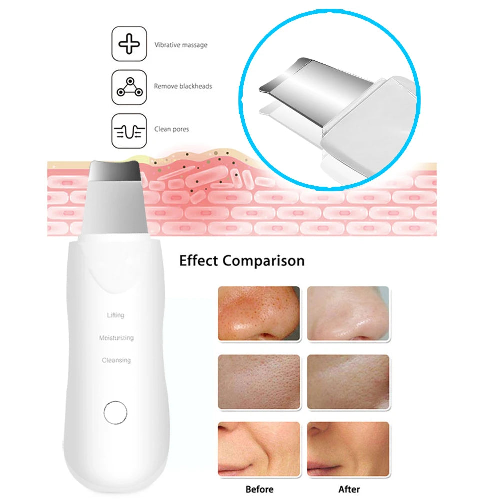 Ultrasonic Skin Scrubber Deep Vibrate Facial Cleaner Shovel Face Scrubber Peeling Black Head Remover Facial Massager